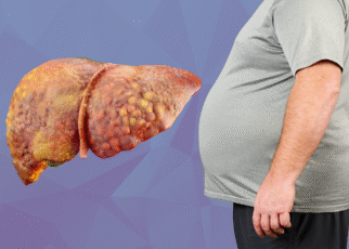 fatty-liver-disease