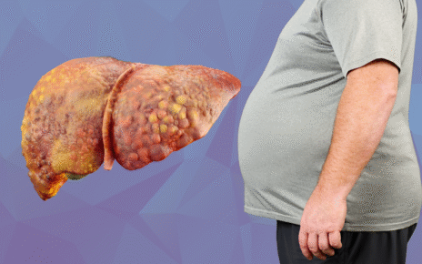 fatty-liver-disease
